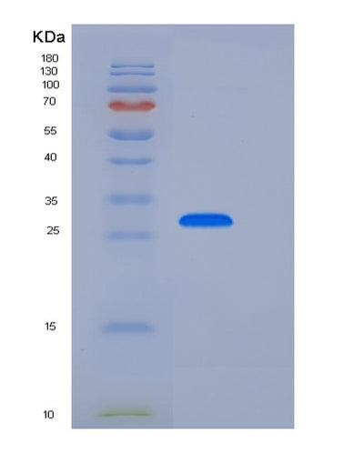 SDS-PAGE analysis of Human CD33 (Myeloid Cell Surface Antigen Cd33) - Recombinant Protein, CAT# BLT-05715P, showing >90% purity under 15% SDS-PAGE (Reduced)Human CD33 (Myeloid Cell Surface Antigen Cd33) - Recombinant Protein