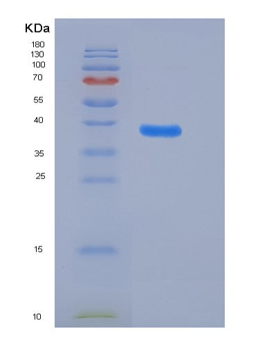 SDS-PAGE analysis of Human ADM (Pro-Adrenomedullin) - Recombinant Protein, CATHuman ADM (Pro-Adrenomedullin) - Recombinant Protein