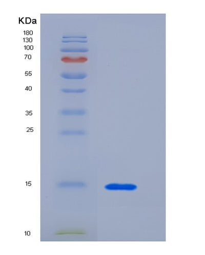SDS-PAGE analysis of Human CEACAM3 (Cell Adhesion Molecule Ceacam3) - Recombinant Protein, CAT# BLT-05719P, showing >85% purity under 15% SDS-PAGE (Reduced)Human CEACAM3 (Cell Adhesion Molecule Ceacam3) - Recombinant Protein