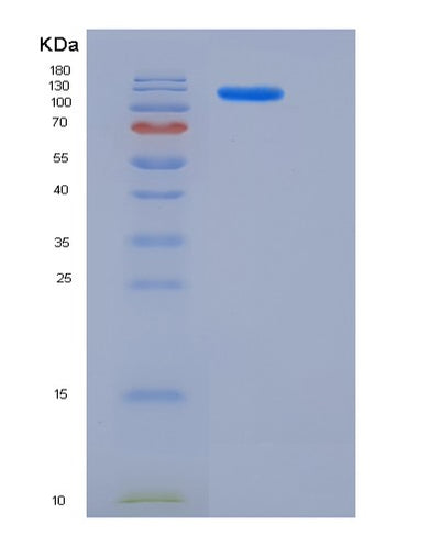 SDS-PAGE analysis of Human ACLY (Atp-Citrate Synthase) - Recombinant Protein, CAT# BLT-05722P, showing >85% purity under 15% SDS-PAGE (Reduced)Human ACLY (Atp-Citrate Synthase) - Recombinant Protein