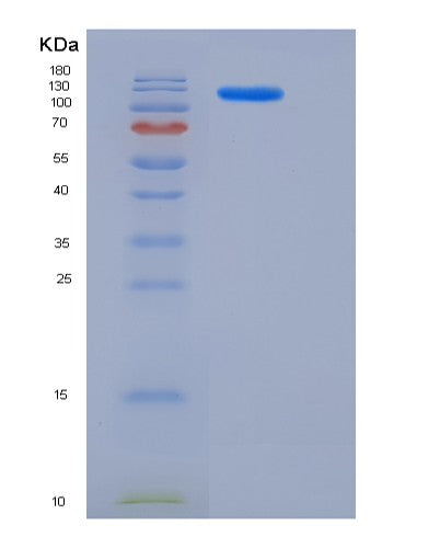 SDS-PAGE analysis of Human ACLY (Atp-Citrate Synthase) - Recombinant Protein, CATHuman ACLY (Atp-Citrate Synthase) - Recombinant Protein