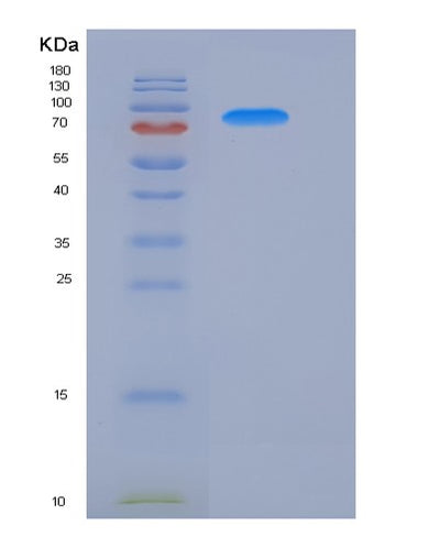 SDS-PAGE analysis of Human ATF2 (Cyclic Amp-Dependent Transcription Factor Atf-2) - Recombinant Protein, CAT# BLT-05723P, showing >90% purity under 15% SDS-PAGE (Reduced)Human ATF2 (Cyclic Amp-Dependent Transcription Factor Atf-2) - Recombinant Protein