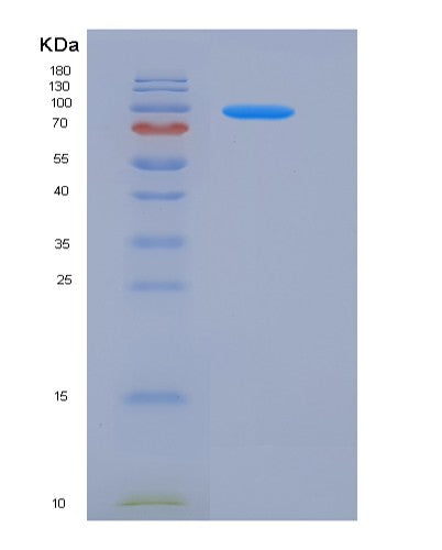 SDS-PAGE analysis of Human TPO (Thyroid Peroxidase) - Recombinant Protein, CATHuman TPO (Thyroid Peroxidase) - Recombinant Protein