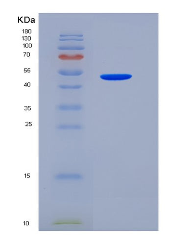 SDS-PAGE analysis of Human VNN1 (Pantetheinase) - Recombinant Protein, CAT# BLT-05728P, showing >85% purity under 15% SDS-PAGE (Reduced)Human VNN1 (Pantetheinase) - Recombinant Protein