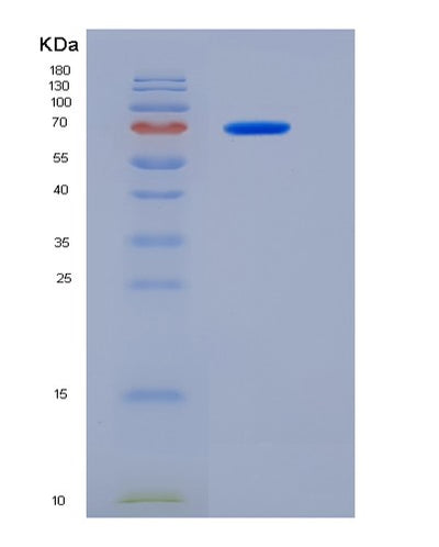 SDS-PAGE analysis of Human MTSS1 (Protein Mtss 1) - Recombinant Protein, CAT# BLT-05732P, showing >95% purity under 15% SDS-PAGE (Reduced)Human MTSS1 (Protein Mtss 1) - Recombinant Protein