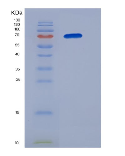 SDS-PAGE analysis of Human B3GNT2 - Recombinant Protein, CAT# BLT-05737P, showing >85% purity under 15% SDS-PAGE (Reduced)Human B3GNT2 - Recombinant Protein