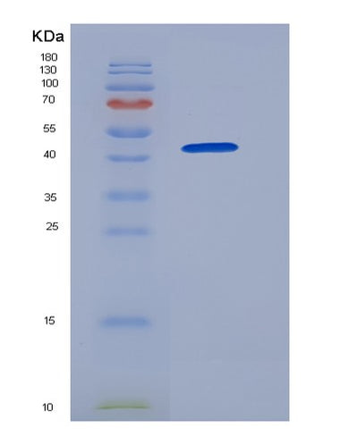 SDS-PAGE analysis of Human GOLM1 (Golgi Membrane Protein 1) - Recombinant Protein, CAT# BLT-05739P, showing >90% purity under 15% SDS-PAGE (Reduced)Human GOLM1 (Golgi Membrane Protein 1) - Recombinant Protein