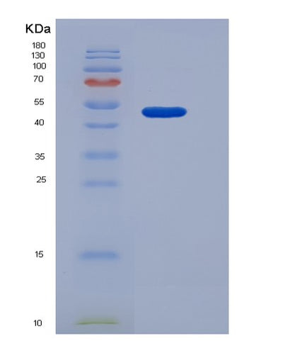 SDS-PAGE analysis of Human IL2RB (Interleukin-2 Receptor Subunit Beta) - Recombinant Protein, CAT# BLT-05740P, showing >85% purity under 15% SDS-PAGE (Reduced)Human IL2RB (Interleukin-2 Receptor Subunit Beta) - Recombinant Protein