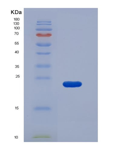 SDS-PAGE analysis of Mouse Procr (Endothelial Protein C Receptor) - Recombinant Protein, CAT# BLT-05741P, showing >95% purity under 15% SDS-PAGE (Reduced)Mouse Procr (Endothelial Protein C Receptor) - Recombinant Protein
