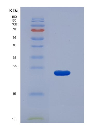 SDS-PAGE analysis of Mouse Procr (Endothelial Protein C Receptor) - Recombinant Protein, CATMouse Procr (Endothelial Protein C Receptor) - Recombinant Protein