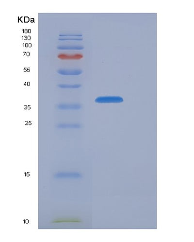 SDS-PAGE analysis of Human CFHR1 (Complement Factor H-Related Protein 1) - Recombinant Protein, CAT# BLT-05743P, showing >95% purity under 15% SDS-PAGE (Reduced)Human CFHR1 (Complement Factor H-Related Protein 1) - Recombinant Protein