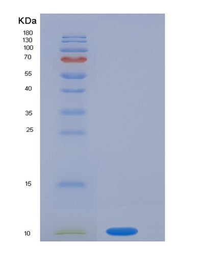 SDS-PAGE analysis of Human S100P (Protein S100-P) - Recombinant Protein, CAT# BLT-05748P, showing >85% purity under 15% SDS-PAGE (Reduced)Human S100P (Protein S100-P) - Recombinant Protein