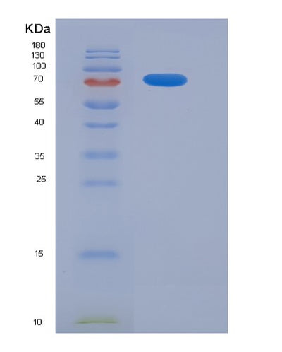 SDS-PAGE analysis of Human CD93 (Complement Component C1Q Receptor) - Recombinant Protein, CAT# BLT-05752P, showing >95% purity under 15% SDS-PAGE (Reduced)Human CD93 (Complement Component C1Q Receptor) - Recombinant Protein