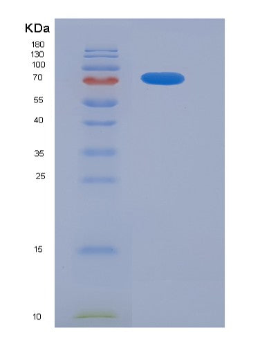 SDS-PAGE analysis of Human CD93 (Complement Component C1Q Receptor) - Recombinant Protein, CATHuman CD93 (Complement Component C1Q Receptor) - Recombinant Protein