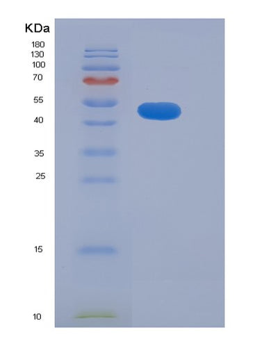 SDS-PAGE analysis of Human ADAM15 (Disintegrin And Metalloproteinase Domain-Containing Protein 15) - Recombinant Protein, CAT# BLT-06346P, showing >90% purity under 15% SDS-PAGE (Reduced)Human ADAM15 (Disintegrin And Metalloproteinase Domain-Containing Protein 15) - Recombinant Protein