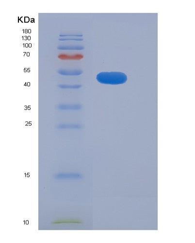 SDS-PAGE analysis of Human ADAM15 (Disintegrin And Metalloproteinase Domain-Containing Protein 15) - Recombinant Protein, CATHuman ADAM15 (Disintegrin And Metalloproteinase Domain-Containing Protein 15) - Recombinant Protein