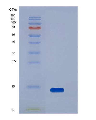 SDS-PAGE analysis of Human AGRP (Agouti-Related Protein) - Recombinant Protein, CAT# BLT-05754P, showing >85% purity under 15% SDS-PAGE (Reduced)Human AGRP (Agouti-Related Protein) - Recombinant Protein