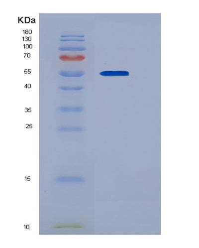 SDS-PAGE analysis of Human ADAM15 (Disintegrin And Metalloproteinase Domain-Containing Protein 15) - Recombinant Protein, CAT# BLT-05756P, showing >90% purity under 15% SDS-PAGE (Reduced)Human ADAM15 (Disintegrin And Metalloproteinase Domain-Containing Protein 15) - Recombinant Protein