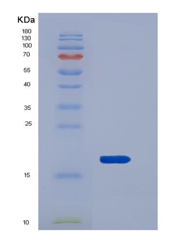 SDS-PAGE analysis of Mouse Reg3b (Regenerating Islet-Derived Protein 3-Beta) - Recombinant Protein, CAT# BLT-05757P, showing >85% purity under 15% SDS-PAGE (Reduced)Mouse Reg3b (Regenerating Islet-Derived Protein 3-Beta) - Recombinant Protein