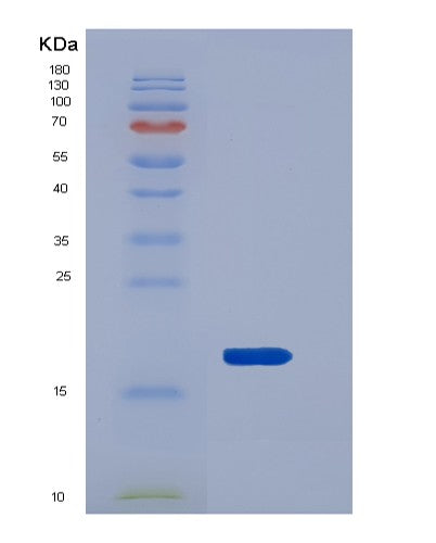 SDS-PAGE analysis of Mouse Reg3b (Regenerating Islet-Derived Protein 3-Beta) - Recombinant Protein, CATMouse Reg3b (Regenerating Islet-Derived Protein 3-Beta) - Recombinant Protein