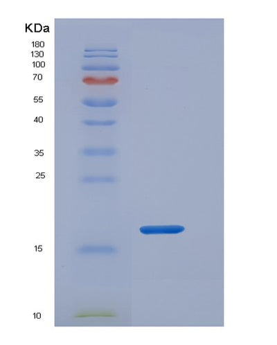 SDS-PAGE analysis of Human REG3A (Regenerating Islet-Derived Protein 3-Alpha) - Recombinant Protein, CAT# BLT-05758P, showing >95% purity under 15% SDS-PAGE (Reduced)Human REG3A (Regenerating Islet-Derived Protein 3-Alpha) - Recombinant Protein