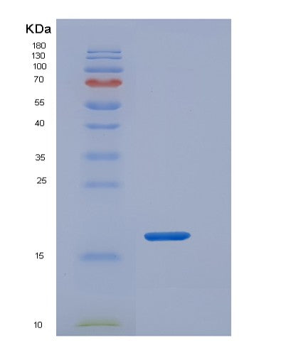 SDS-PAGE analysis of Human REG3A (Regenerating Islet-Derived Protein 3-Alpha) - Recombinant Protein, CATHuman REG3A (Regenerating Islet-Derived Protein 3-Alpha) - Recombinant Protein