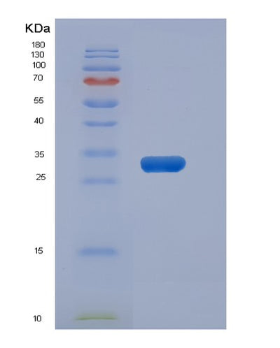 SDS-PAGE analysis of Human METAP1D (Methionine Aminopeptidase 1D, Mitochondrial) - Recombinant Protein, CAT# BLT-05762P, showing >90% purity under 15% SDS-PAGE (Reduced)Human METAP1D (Methionine Aminopeptidase 1D, Mitochondrial) - Recombinant Protein