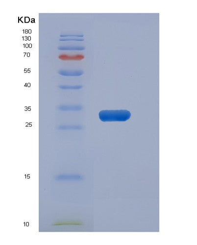 SDS-PAGE analysis of Human METAP1D (Methionine Aminopeptidase 1D, Mitochondrial) - Recombinant Protein, CATHuman METAP1D (Methionine Aminopeptidase 1D, Mitochondrial) - Recombinant Protein