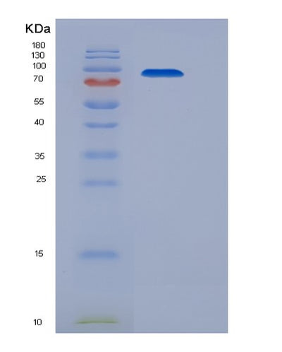 SDS-PAGE analysis of Human AGO1 (Protein Argonaute-1) - Recombinant Protein, CAT# BLT-05764P, showing >90% purity under 15% SDS-PAGE (Reduced)Human AGO1 (Protein Argonaute-1) - Recombinant Protein