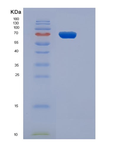 SDS-PAGE analysis of Human CD3E (T-Cell Surface Glycoprotein Cd3 Epsilon Chain) - Recombinant Protein, CAT# BLT-05767P, showing >95% purity under 15% SDS-PAGE (Reduced)Human CD3E (T-Cell Surface Glycoprotein Cd3 Epsilon Chain) - Recombinant Protein