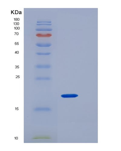 SDS-PAGE analysis of Human CD4 (T-Cell Surface Glycoprotein Cd4) - Recombinant Protein, CAT# BLT-05768P, showing >95% purity under 15% SDS-PAGE (Reduced)Human CD4 (T-Cell Surface Glycoprotein Cd4) - Recombinant Protein