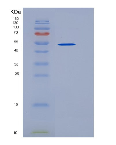 SDS-PAGE analysis of Human CD96 (T-Cell Surface Protein Tactile) - Recombinant Protein, CATHuman CD96 (T-Cell Surface Protein Tactile) - Recombinant Protein