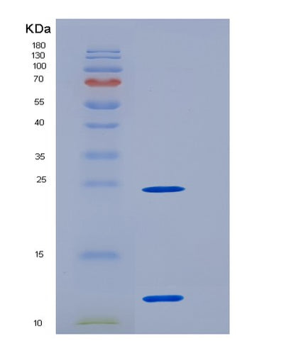 SDS-PAGE analysis of Human S100A11 (Protein S100-A11) - Recombinant Protein, CAT# BLT-05775P, showing >95% purity under 15% SDS-PAGE (Reduced)Human S100A11 (Protein S100-A11) - Recombinant Protein