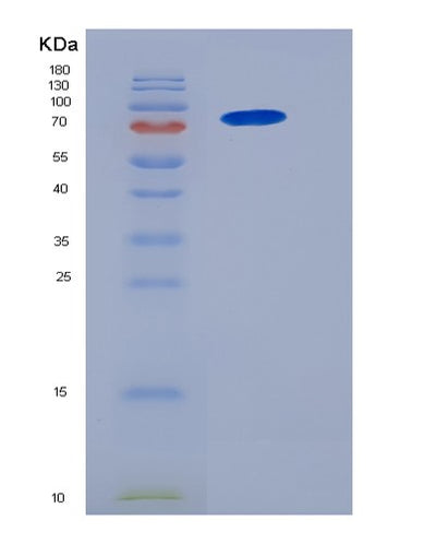SDS-PAGE analysis of Human NCF2 (Neutrophil Cytosol Factor 2) - Recombinant Protein, CAT# BLT-05777P, showing >85% purity under 15% SDS-PAGE (Reduced)Human NCF2 (Neutrophil Cytosol Factor 2) - Recombinant Protein