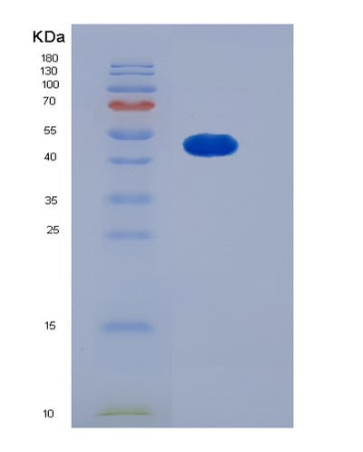 SDS-PAGE analysis of Human SMYD2 (N-Lysine Methyltransferase Smyd2) - Recombinant Protein, CAT# BLT-05778P, showing >90% purity under 15% SDS-PAGE (Reduced)Human SMYD2 (N-Lysine Methyltransferase Smyd2) - Recombinant Protein