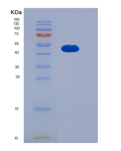 SDS-PAGE analysis of Human SMYD2 (N-Lysine Methyltransferase Smyd2) - Recombinant Protein, CATHuman SMYD2 (N-Lysine Methyltransferase Smyd2) - Recombinant Protein