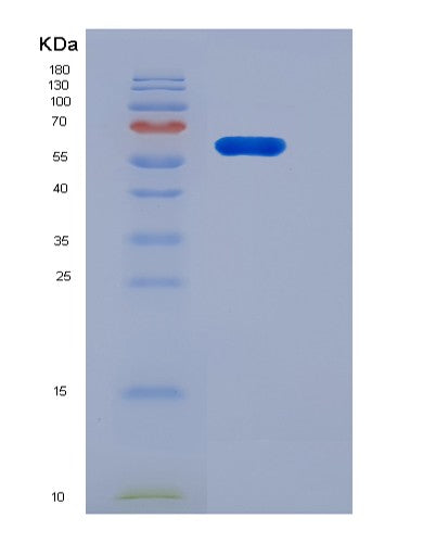 SDS-PAGE analysis of Human IGSF8 (Immunoglobulin Superfamily Member 8) - Recombinant Protein, CATHuman IGSF8 (Immunoglobulin Superfamily Member 8) - Recombinant Protein