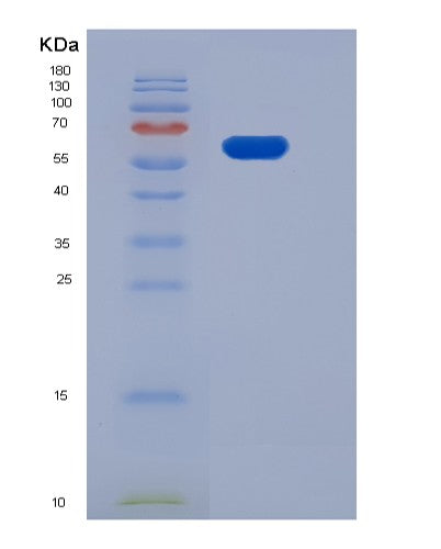 SDS-PAGE analysis of Human EPHB1 (Ephrin Type-B Receptor 1) - Recombinant Protein, CATHuman EPHB1 (Ephrin Type-B Receptor 1) - Recombinant Protein