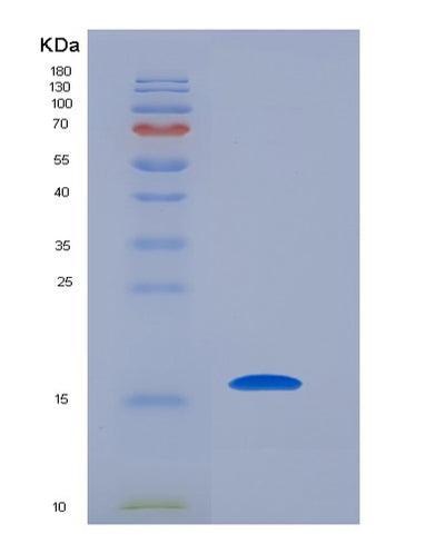 SDS-PAGE analysis of Human BIRC5 (Baculoviral Iap Repeat-Containing Protein 5) - Recombinant Protein, CAT# BLT-05792P, showing >85% purity under 15% SDS-PAGE (Reduced)Human BIRC5 (Baculoviral Iap Repeat-Containing Protein 5) - Recombinant Protein