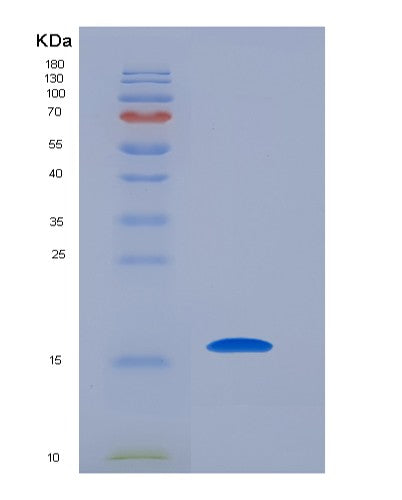 SDS-PAGE analysis of Human BIRC5 (Baculoviral Iap Repeat-Containing Protein 5) - Recombinant Protein, CATHuman BIRC5 (Baculoviral Iap Repeat-Containing Protein 5) - Recombinant Protein
