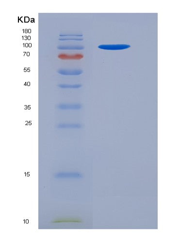 SDS-PAGE analysis of Mouse Vcl (Vinculin) - Recombinant Protein, CATMouse Vcl (Vinculin) - Recombinant Protein