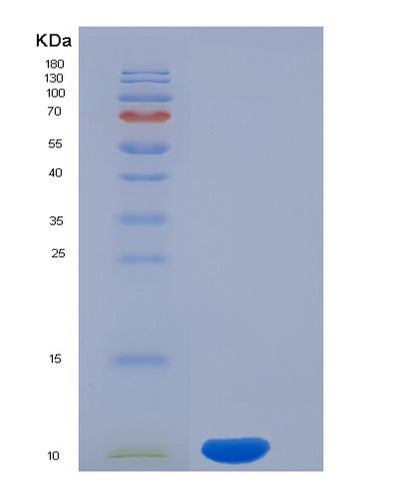 SDS-PAGE analysis of Human CD3D (T-Cell Surface Glycoprotein Cd3 Delta Chain) - Recombinant Protein, CAT# BLT-05795P, showing >85% purity under 15% SDS-PAGE (Reduced)Human CD3D (T-Cell Surface Glycoprotein Cd3 Delta Chain) - Recombinant Protein