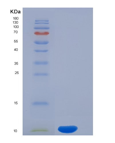 SDS-PAGE analysis of Human CD3D (T-Cell Surface Glycoprotein Cd3 Delta Chain) - Recombinant Protein, CATHuman CD3D (T-Cell Surface Glycoprotein Cd3 Delta Chain) - Recombinant Protein