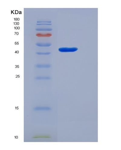 SDS-PAGE analysis of Human CBLIF (Cobalamin Binding Intrinsic Factor) - Recombinant Protein, CAT# BLT-05798P, showing >85% purity under 15% SDS-PAGE (Reduced)Human CBLIF (Cobalamin Binding Intrinsic Factor) - Recombinant Protein