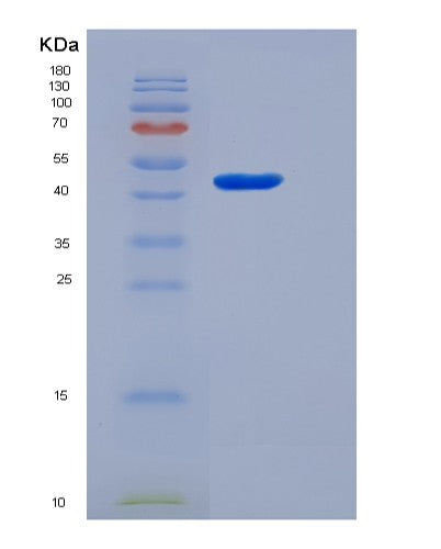 SDS-PAGE analysis of Human CBLIF (Cobalamin Binding Intrinsic Factor) - Recombinant Protein, CATHuman CBLIF (Cobalamin Binding Intrinsic Factor) - Recombinant Protein