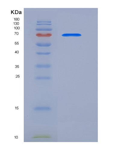 SDS-PAGE analysis of Human CALR (Calreticulin) - Recombinant Protein, CATHuman CALR (Calreticulin) - Recombinant Protein