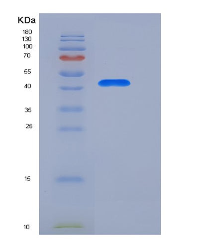 SDS-PAGE analysis of Human REN (Renin) - Recombinant Protein, CAT# BLT-05802P, showing >95% purity under 15% SDS-PAGE (Reduced)Human REN (Renin) - Recombinant Protein
