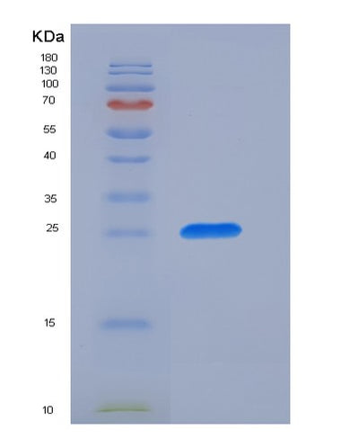 SDS-PAGE analysis of Human FCAR (Immunoglobulin Alpha Fc Receptor) - Recombinant Protein, CAT# BLT-05804P, showing >90% purity under 15% SDS-PAGE (Reduced)Human FCAR (Immunoglobulin Alpha Fc Receptor) - Recombinant Protein