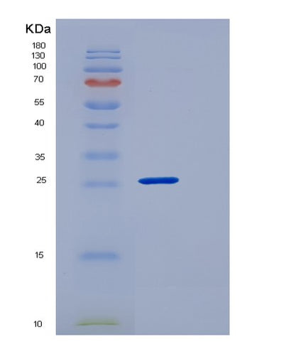 SDS-PAGE analysis of Human CLEC12A (C-Type Lectin Domain Family 12 Member A) - Recombinant Protein, CAT# BLT-05805P, showing >95% purity under 15% SDS-PAGE (Reduced)Human CLEC12A (C-Type Lectin Domain Family 12 Member A) - Recombinant Protein