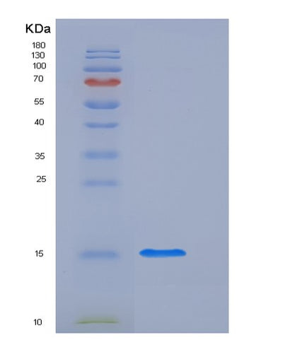 SDS-PAGE analysis of Human FABP1 (Fatty Acid-Binding Protein, Liver) - Recombinant Protein, CAT# BLT-05809P, showing >85% purity under 15% SDS-PAGE (Reduced)Human FABP1 (Fatty Acid-Binding Protein, Liver) - Recombinant Protein